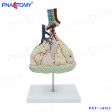 PNT-04151 modelo de cuerpo humano Magnified Pulmonary Alveoli Model